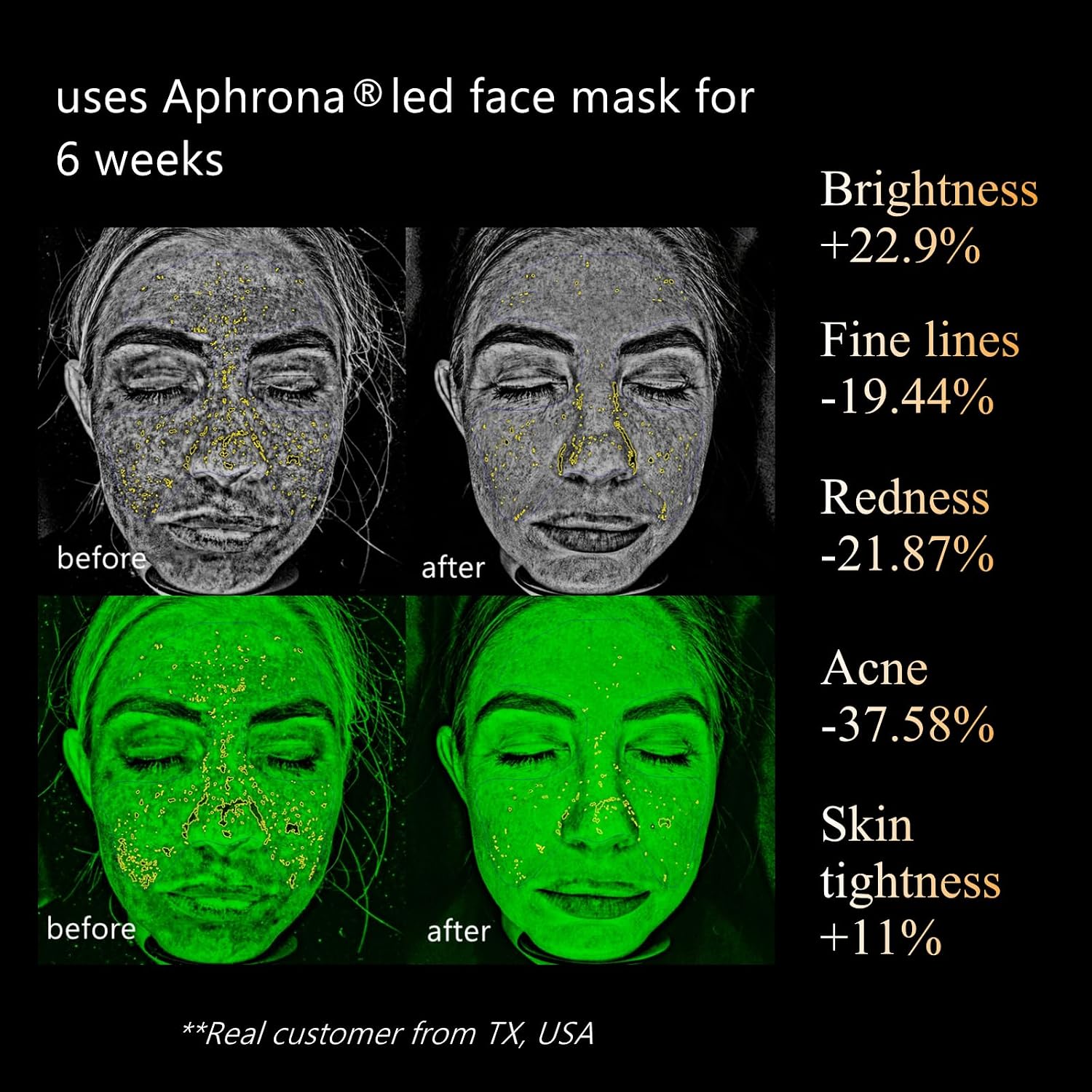 Aphrona Halo Led Face Mask. Led Light Therapy for face. Facial and Neck Skin Care Mask. Blue Light Red Light for Acne treatment Wrinkle Reduce. 807 led chips