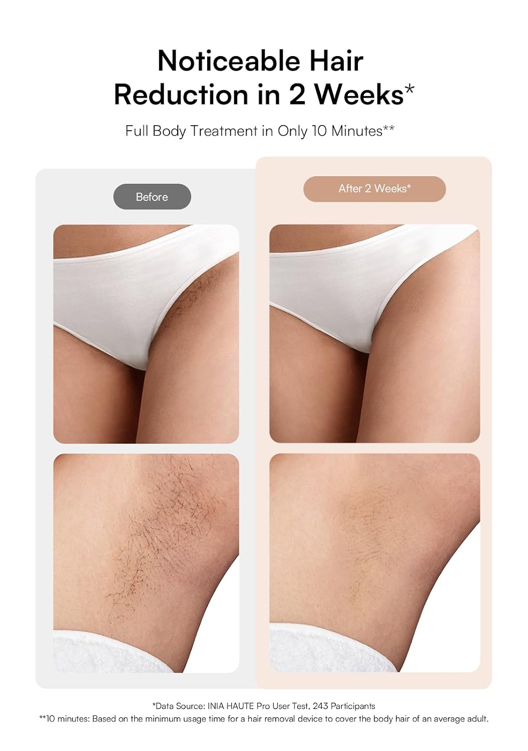 INIA HAUTE Pro Laser Hair Removal with Ice-Cooling Care for Women and Men | Painless at-Home. IPL Hair Remover for Coarse Hair. in Bikini All Body Areas. Latest Generation for Effective Results