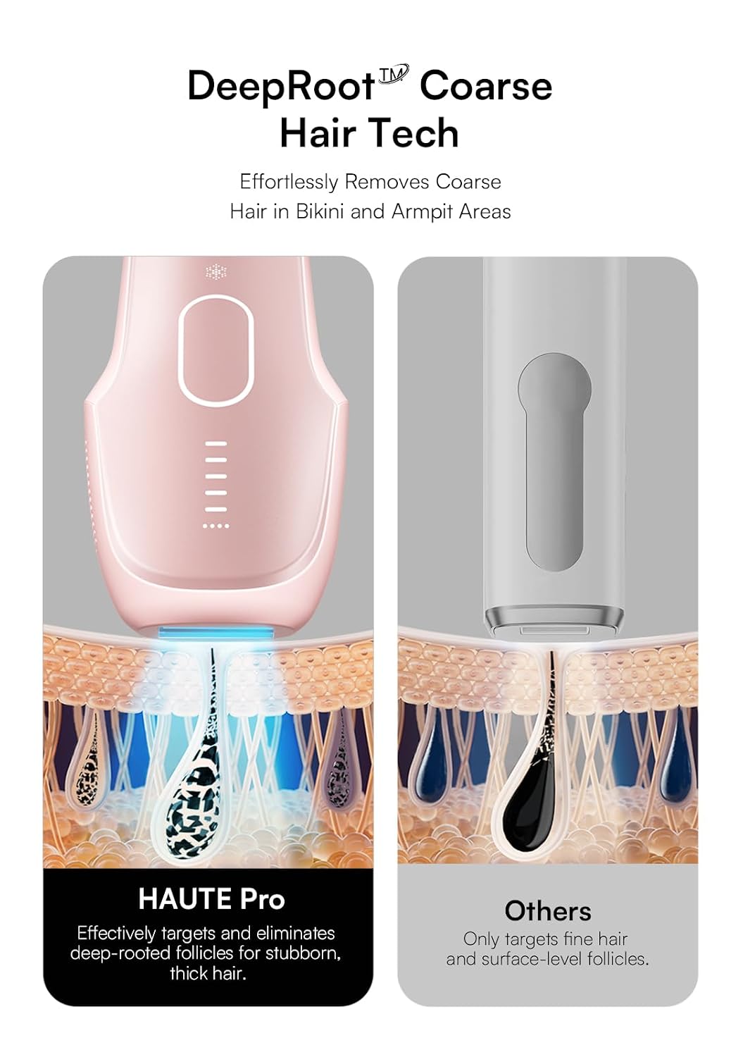 INIA HAUTE Pro Laser Hair Removal with Ice-Cooling Care for Women and Men | Painless at-Home. IPL Hair Remover for Coarse Hair. in Bikini All Body Areas. Latest Generation for Effective Results